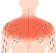 Лечение боли в плечевом суставе